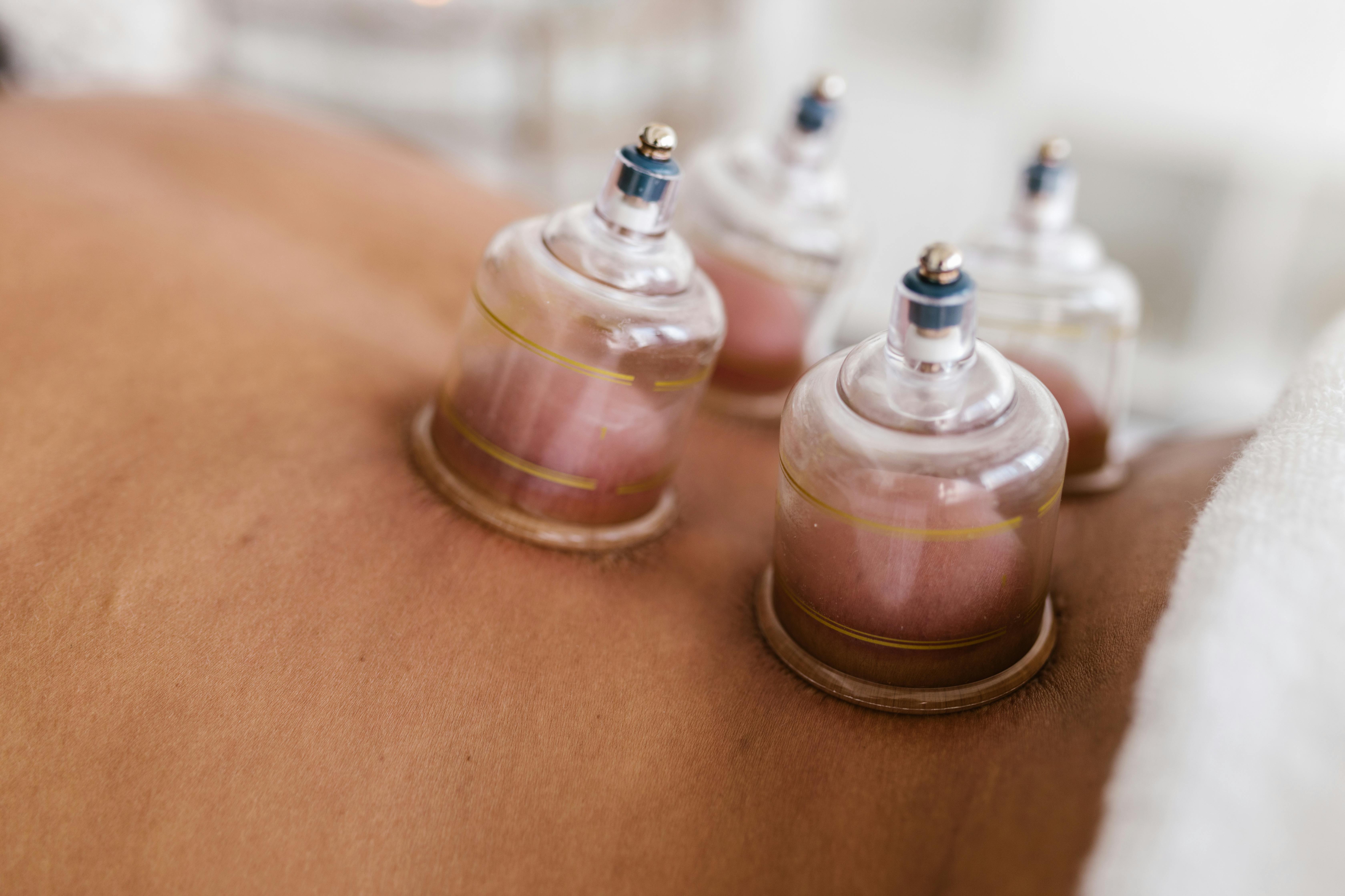 Lower back cupping
