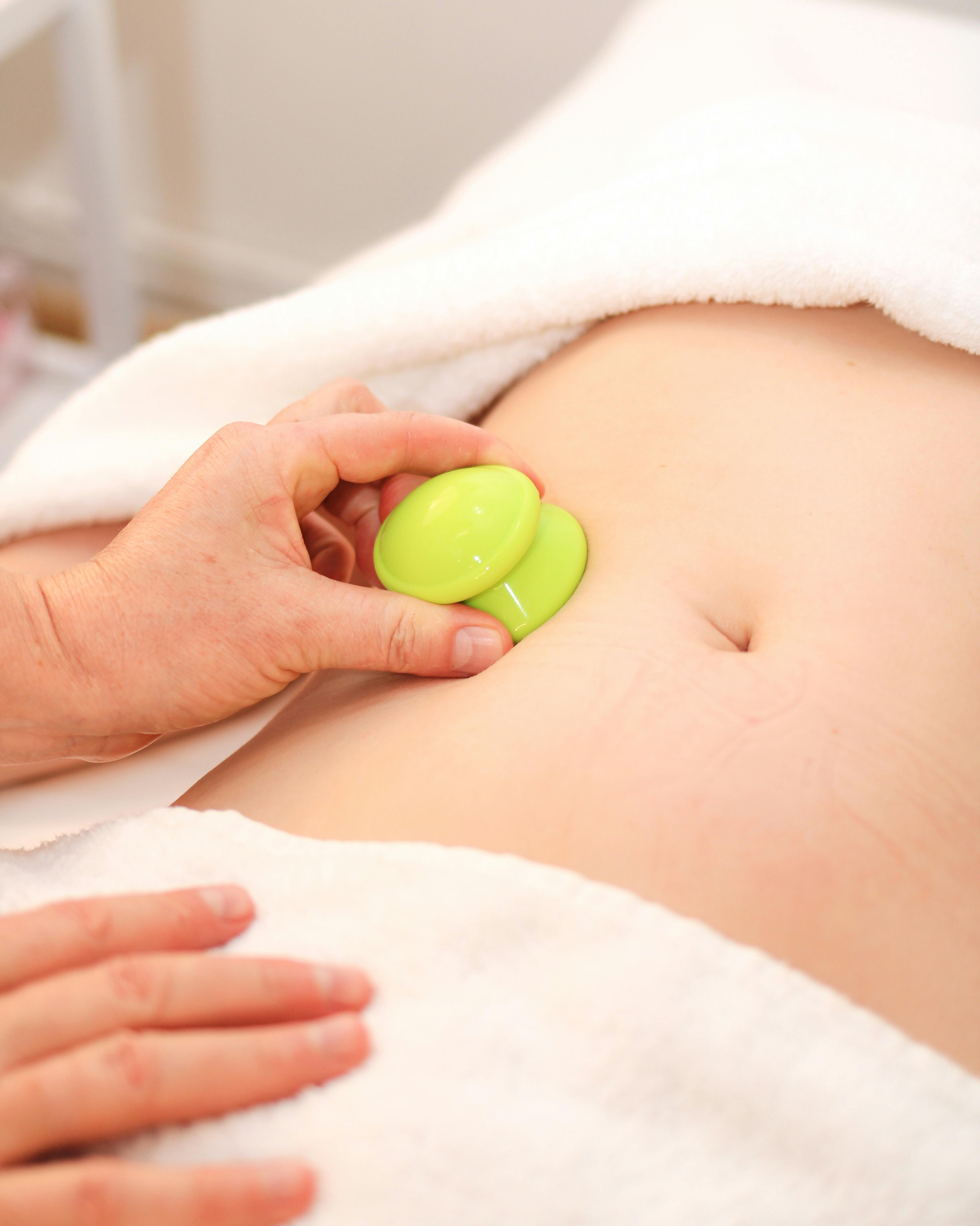 Stomach cupping